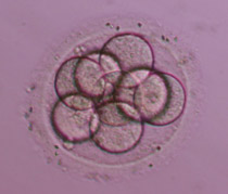 8-cell Grade I  (fertilized with IVF)